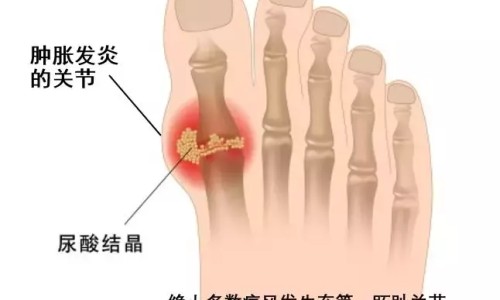 肺炎病人应注意什么网 - 为你提供肺炎患者注意事项、肺炎病人应注意什么事项